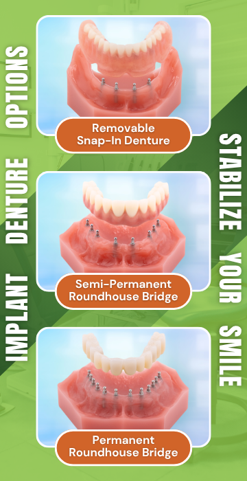 Implant Denture Options in Denver, CO | Free Implant Consultations
