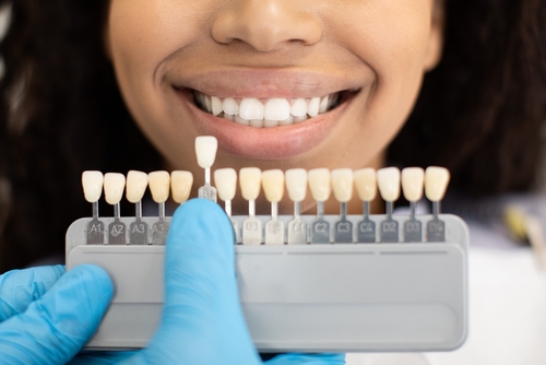 Porcelain Veneers in Denver, CO | Revitalize Your Smile Affordably